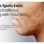 Find Your Right Skin Type and Choose Products That Actually Work