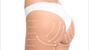How Long Do Results from Butt Fat Transfer Surgery in Dubai Last?