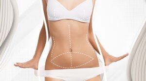 Why Experts Prefer Fat Transfer Surgery in Dubai Over Synthetic Enhancements