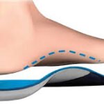 Discover the Comfort You Deserve with Custom Orthotics in London