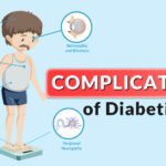 Long term Complications of Diabetes Mellitus