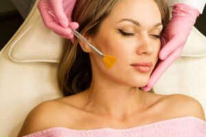 Chemical Peels in Dubai: Benefits for Acne and Pigmentation