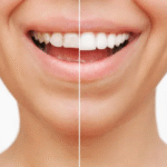 How Do Dental Implants Improve Your Confidence and Oral Health: