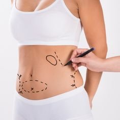 Understanding Different Liposuction Techniques and Benefits