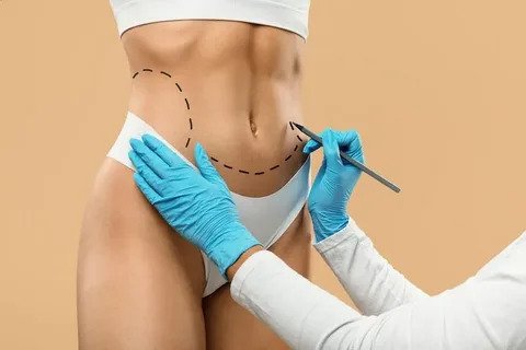 Liposuction in Islamabad: Reshape Your Body Safely and Effectively