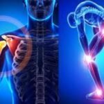 Expert Orthopaedic Care in Jaipur – Dr. Akash Agarwal ECOS Clinic Best Knee & Shoulder Joint Replacement & Arthroscopy Surgeon