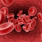 Iron-Deficiency Anemia — Symptoms, Causes & Treatment