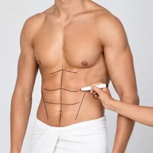 Liposuction in Islamabad: Transform Your Body Safely