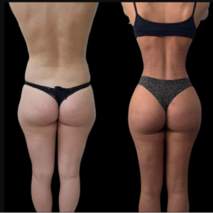 Best Aesthetic Clinics in Dubai for Face and Body J-Plasma Treatments