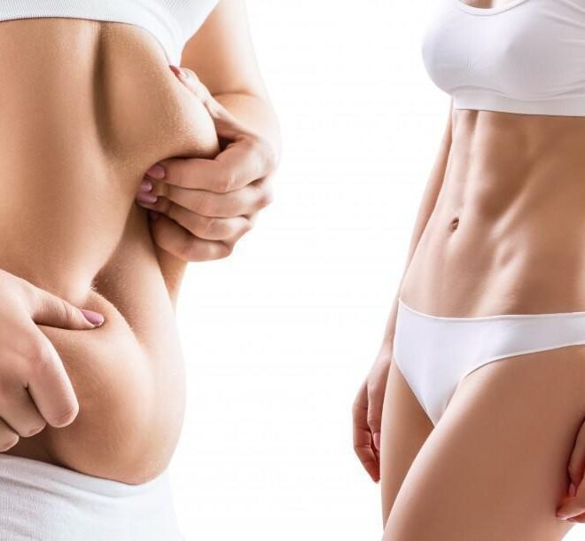 Discover the Best Liposuction Surgeon in Dubai for Your Dream Body
