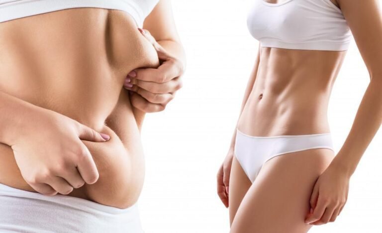 Discover the Best Liposuction Surgeon in Dubai for Your Dream Body