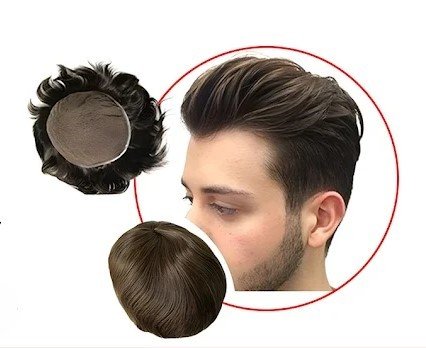 Non-Surgical Hair Replacement: Benefits & Results