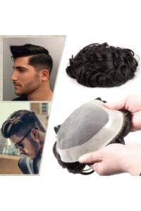 Hair Replacement Systems: How They Work