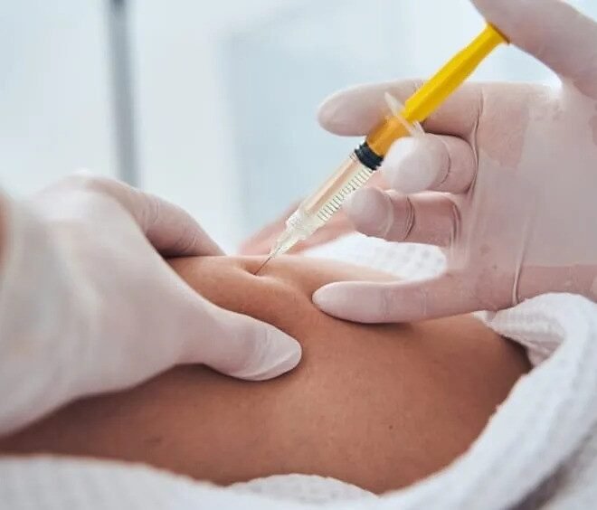 Lemon Bottle Injection for Smooth Body Contours