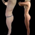 Best Doctors in Dubai for J-Plasma: A Modern Approach to Skin Rejuvenation