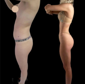 J-Plasma Skin Rejuvenation at the Best Aesthetic Clinic in Dubai