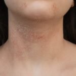 Yonsei University College of Medicine Gangnam Severance Hospital: A Beacon of Healthcare Excellence in Seoul