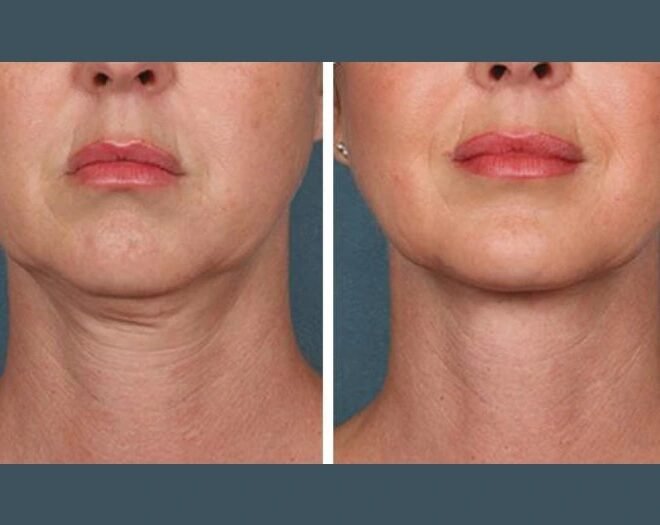 Best Plastic Surgeons in Dubai Enhancing Results with PRP Treatment