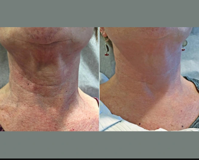 Why Best Doctors in Dubai Are Leading Skin Tightening Innovations