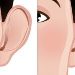 Ear Reshaping in Islamabad: Correct Protruding and Asymmetrical Ears