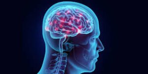Affordable Brain Hemorrhage Treatment Cost in India | IR Facilities