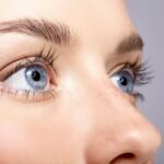 Upper Blepharoplasty in London: How Is Excess Eyelid Skin Assessed Before Surgery?