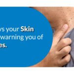 10 Ways Your Skin May Be Warning You of Diabetes