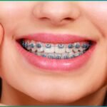 Dental Implant Near Me | Get Expert Dental Implant Treatment