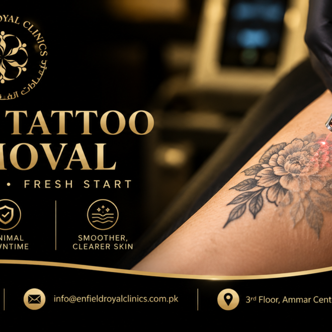 Is Tattoo Removal Possible Without Laser Treatment?